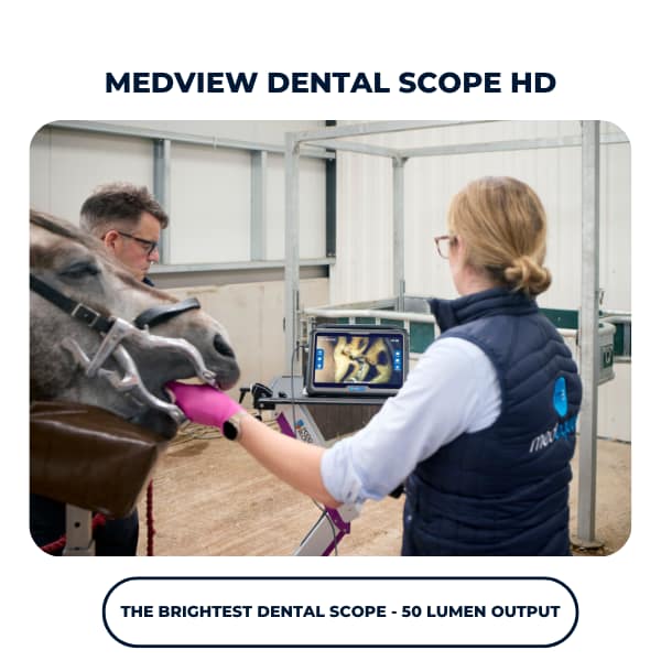 Medview HD Dental Scope
